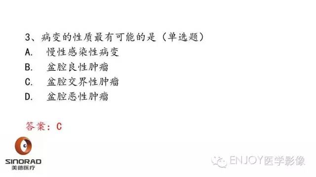 【病例】卵巢交界性浆液性表面乳头状瘤1例MR病例读片