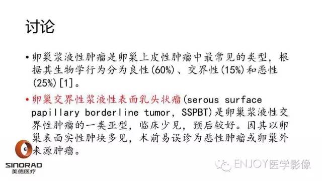 【病例】卵巢交界性浆液性表面乳头状瘤1例MR病例读片