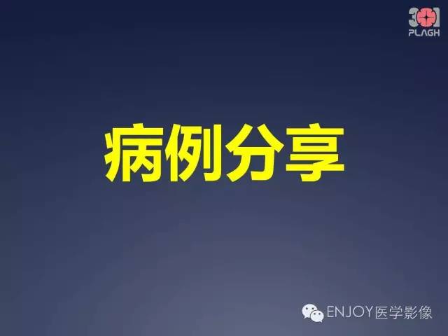 【病例】双肾透明细胞癌1例MR病例读片 【病例】双肾透明细胞癌1例MR病例读片