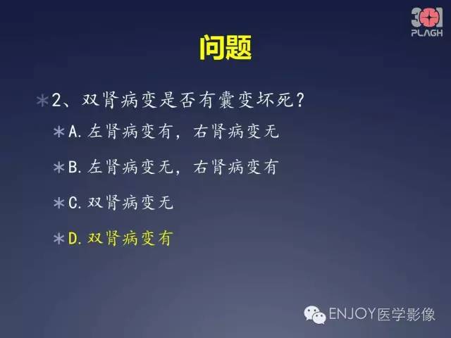 【病例】双肾透明细胞癌1例MR病例读片 【病例】双肾透明细胞癌1例MR病例读片
