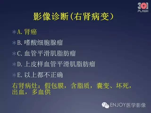 【病例】双肾透明细胞癌1例MR病例读片 【病例】双肾透明细胞癌1例MR病例读片