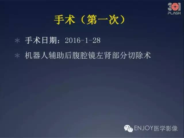 【病例】双肾透明细胞癌1例MR病例读片 【病例】双肾透明细胞癌1例MR病例读片