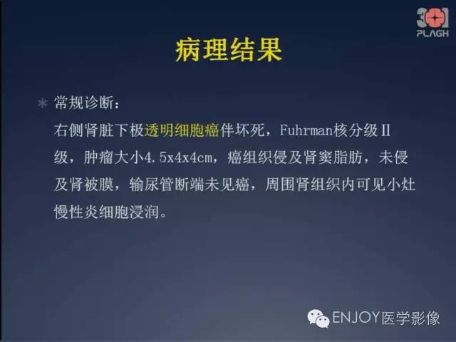 【病例】双肾透明细胞癌1例MR病例读片 【病例】双肾透明细胞癌1例MR病例读片