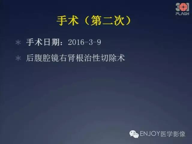 【病例】双肾透明细胞癌1例MR病例读片 【病例】双肾透明细胞癌1例MR病例读片