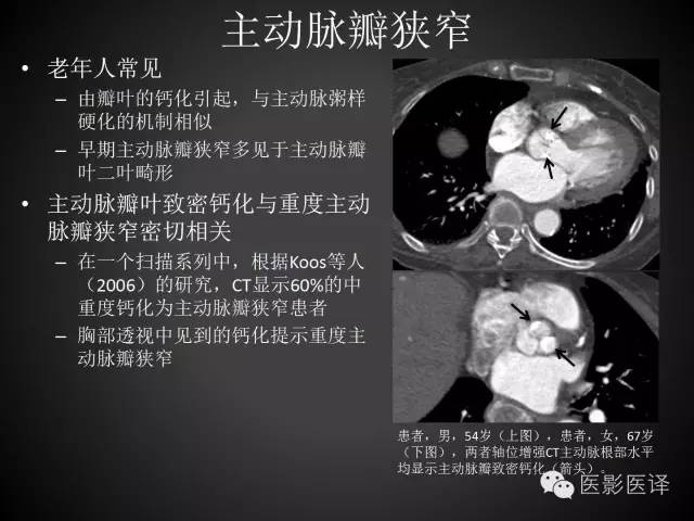 普通放射科医生需要了解的成人心脏瓣膜病知识 普通放射科医生需要了解的成人心脏瓣膜病知识