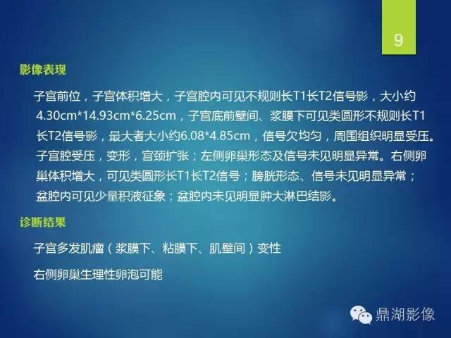 【病例】子宫内膜间质肉瘤1例MR病例讨论