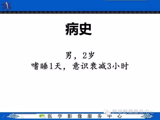 【病例】幼儿侧脑室胶质母细胞瘤1例MR影像表现