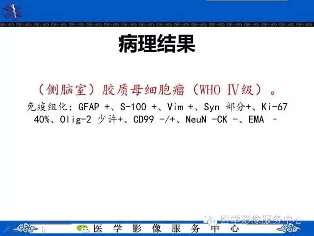 【病例】幼儿侧脑室胶质母细胞瘤1例MR影像表现