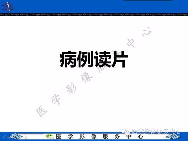 【病例】胃重复畸形1例CT影像表现
