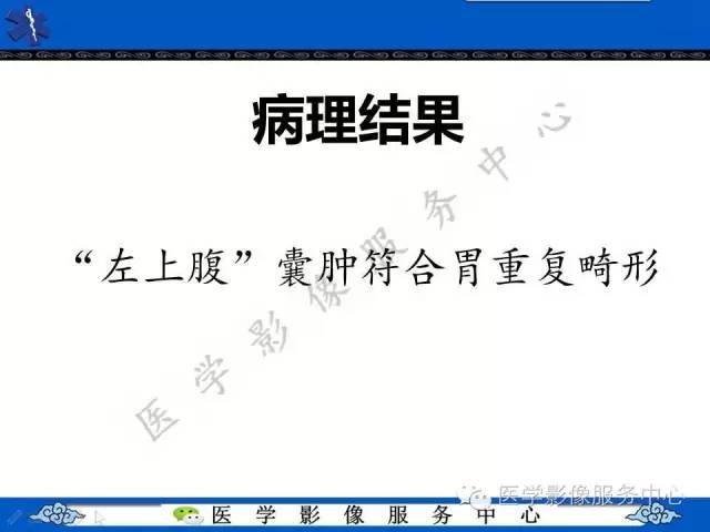 【病例】胃重复畸形1例CT影像表现