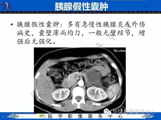 【病例】胃重复畸形1例CT影像表现