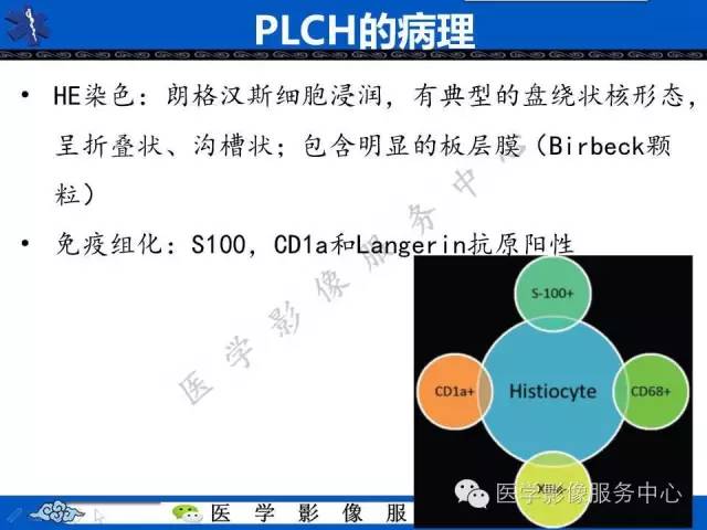 【PPT】胸部组织细胞病变的影像学表现