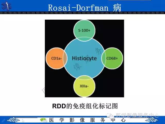 【PPT】胸部组织细胞病变的影像学表现
