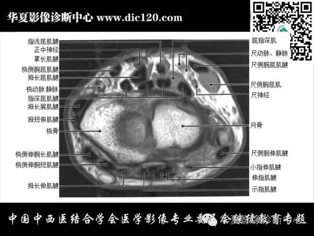 【PPT】腕关节解剖常见病影像诊断