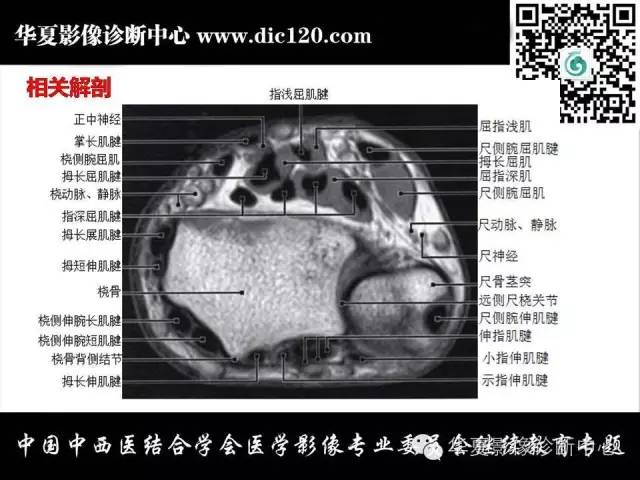 【PPT】腕关节解剖常见病影像诊断