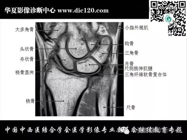 【PPT】腕关节解剖常见病影像诊断