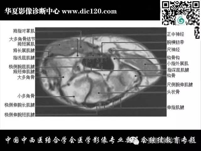 【PPT】腕关节解剖常见病影像诊断