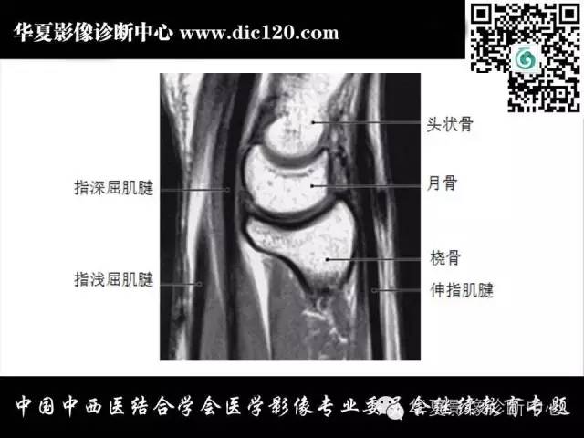 【PPT】腕关节解剖常见病影像诊断