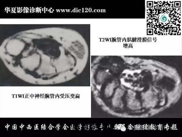 【PPT】腕关节解剖常见病影像诊断