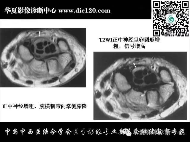 【PPT】腕关节解剖常见病影像诊断