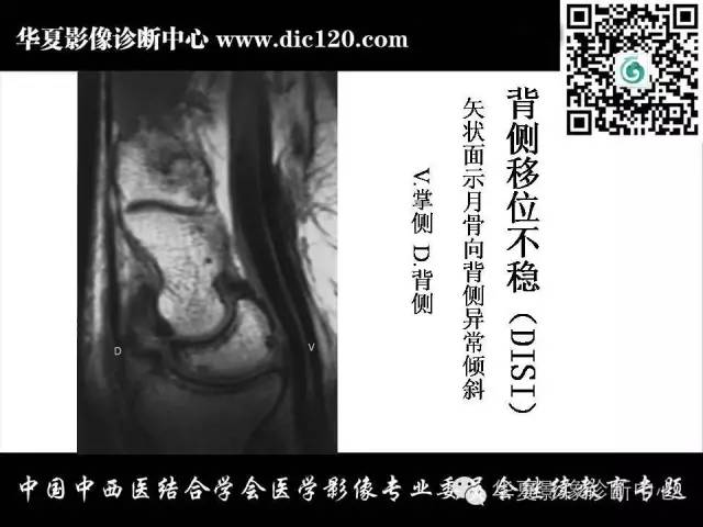 【PPT】腕关节解剖常见病影像诊断