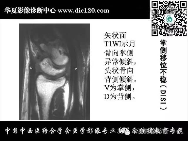 【PPT】腕关节解剖常见病影像诊断