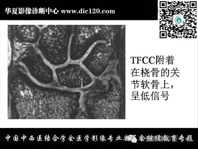 【PPT】腕关节解剖常见病影像诊断