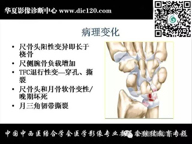 【PPT】腕关节解剖常见病影像诊断