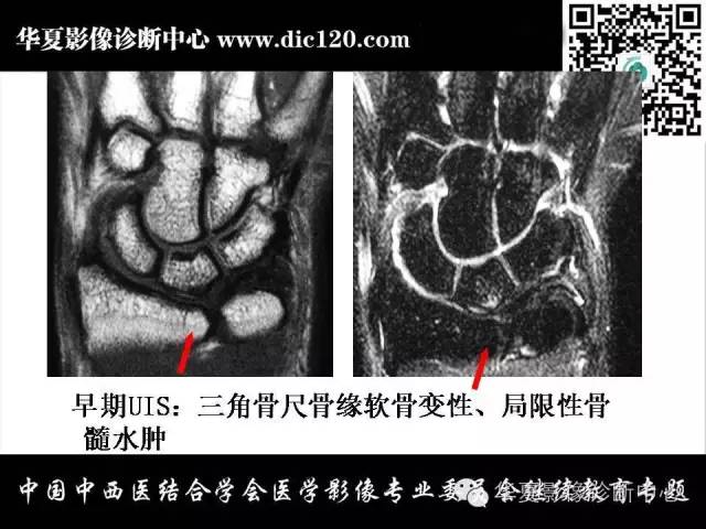【PPT】腕关节解剖常见病影像诊断
