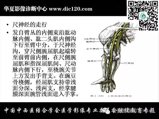 【PPT】腕关节解剖常见病影像诊断