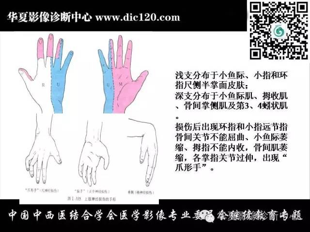 【PPT】腕关节解剖常见病影像诊断