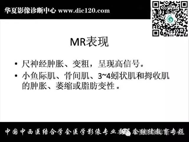 【PPT】腕关节解剖常见病影像诊断