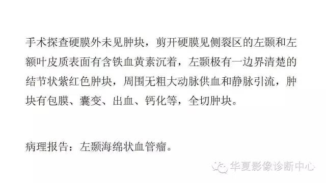 【病例】鞍旁脑外海绵状血管瘤1例MR影像表现