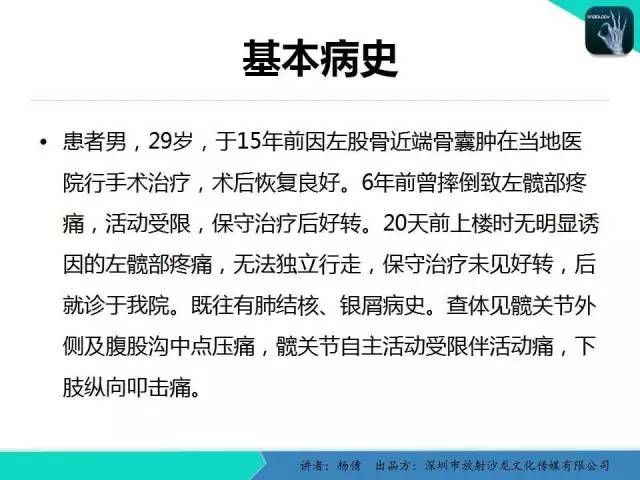 【病例】动脉瘤样骨囊肿1例影像分析