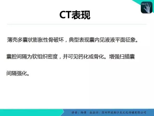 【病例】动脉瘤样骨囊肿1例影像分析