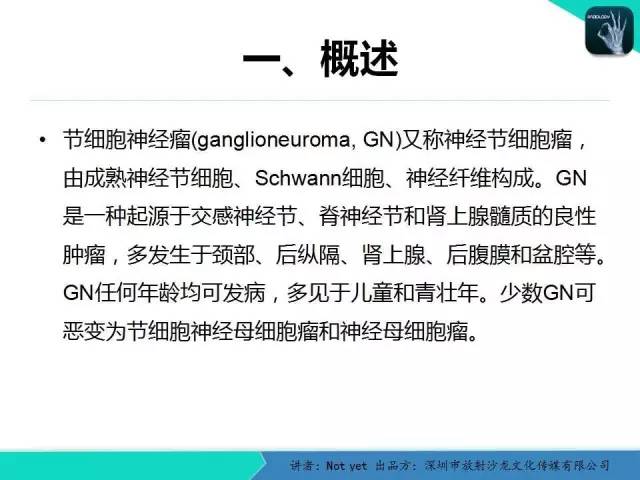 【病例】肾上腺节细胞神经瘤1例CT影像分诊断与鉴别