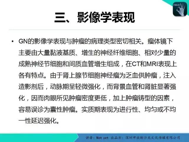 【病例】肾上腺节细胞神经瘤1例CT影像分诊断与鉴别