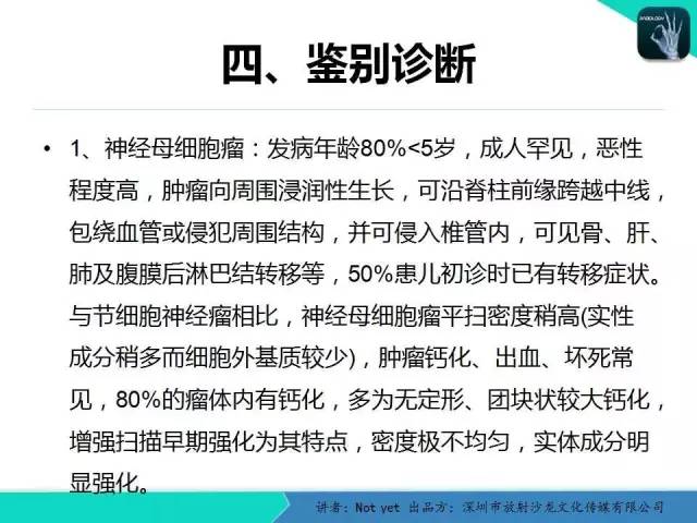 【病例】肾上腺节细胞神经瘤1例CT影像分诊断与鉴别
