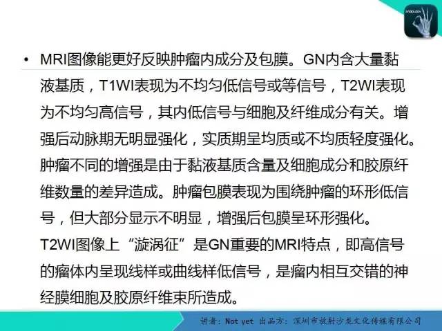 【病例】肾上腺节细胞神经瘤1例CT影像分诊断与鉴别
