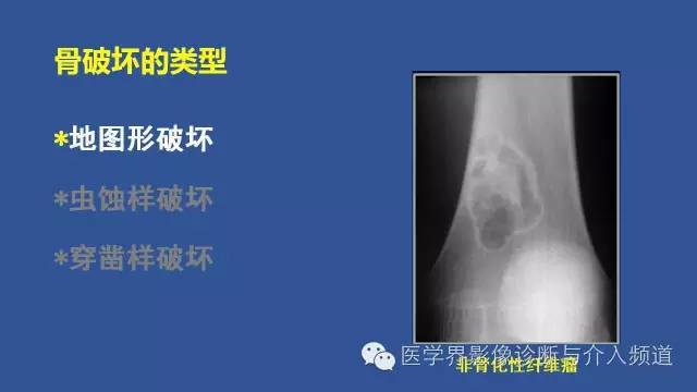 【PPT】识骨寻踪