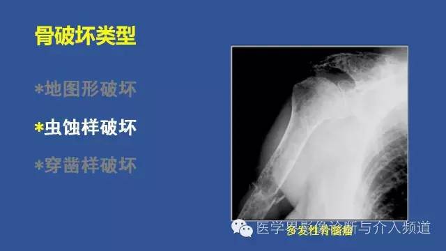 【PPT】识骨寻踪