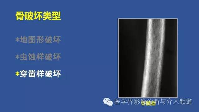【PPT】识骨寻踪