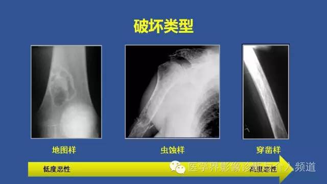 【PPT】识骨寻踪