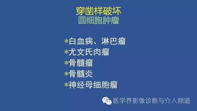 【PPT】识骨寻踪