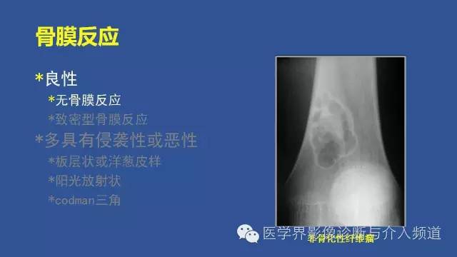 【PPT】识骨寻踪