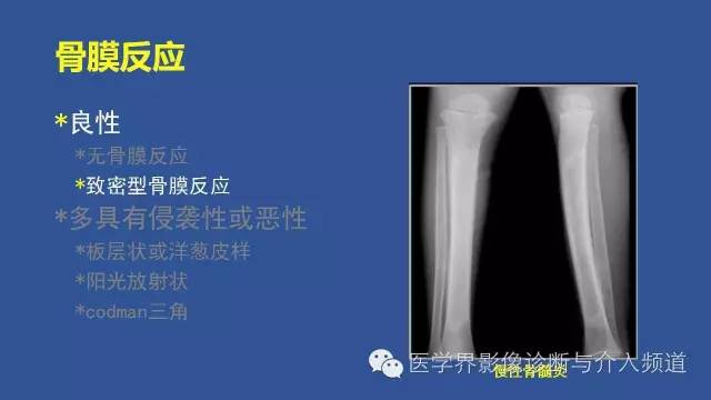 【PPT】识骨寻踪