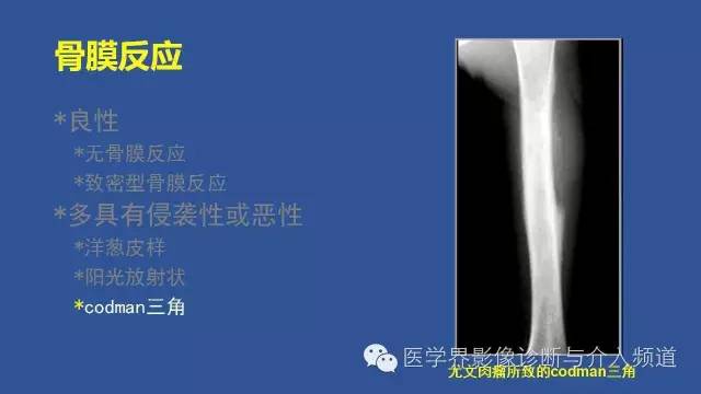 【PPT】识骨寻踪