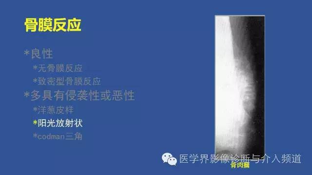 【PPT】识骨寻踪