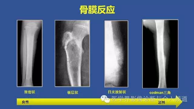 【PPT】识骨寻踪