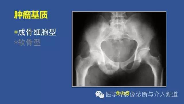 【PPT】识骨寻踪